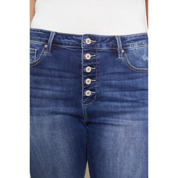 close up of button fly of denim bermuda shorts